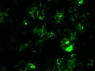 CD11b Works Very Well