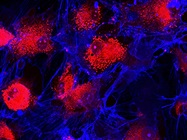 Optimizing Live-Cell Imaging