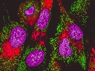 Five Reasons to Consider Using Labeled Primary Antibodies for Multiplexing