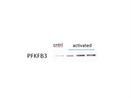 Great Antibody for PFKFB3 Detection