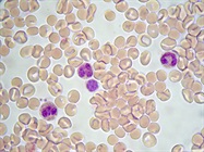 Expanding the Scope of Single-Cell Research with the WOLF G2 Cell Sorter