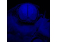 DAPI Solution Works Great