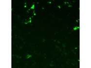 Excellent Anti-CD1a Antibody