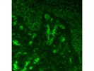 Antibody Stains HLA-ABC Very Well