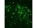 Vimentin Antibody Works Well