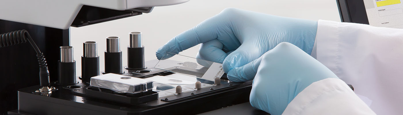 Improved Tissue Dissection for NGS and PCR with the AVENIO Millisect System