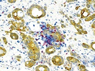 Tips for Successful IHC Staining