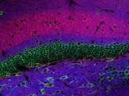 Tips on Purchasing and Using Fluorescence Microscopes