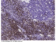 Recombinant Anti-CD3D & CD3E Heterodimer Antibody