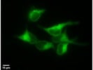Efficient in Transfecting Plasmid DNA into HEK293 cells