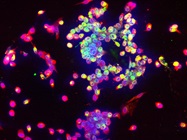 Immuno-oncology Research Tools