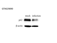 Great SQSTM1 / P62 Antibody from GeneTex