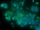 Great Beta Catenin Antibody