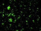 Good Antibody to Label ß-Amyloid Peptide