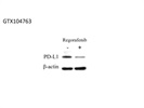 Great PD-L1 Antibody