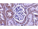 Really Good PHB2 Antibody