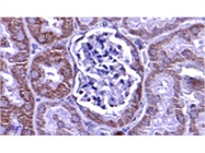 Really Good PHB2 Antibody