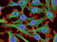 How to Prevent Cell-Culture Contamination