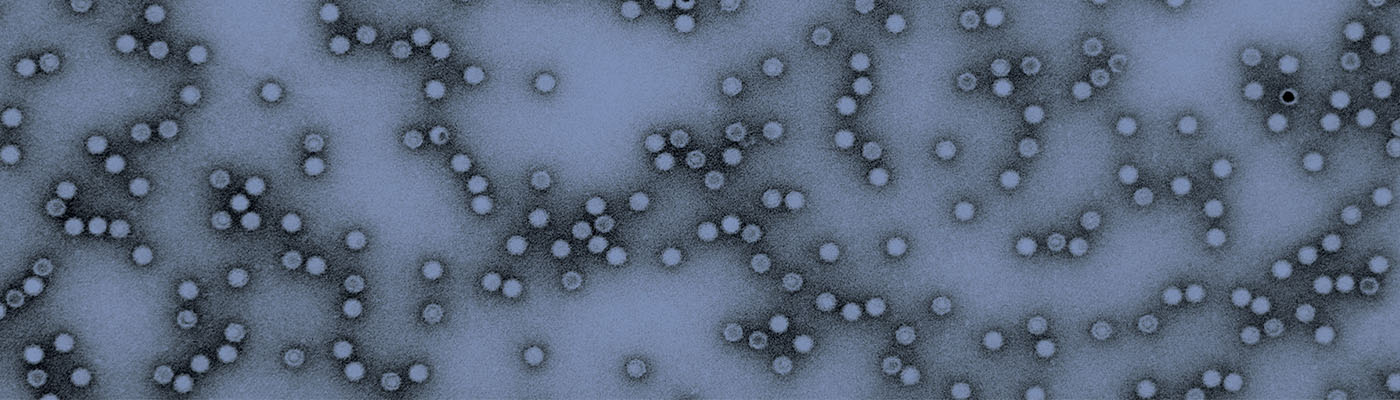  The MockV MVM Assay Kita Practical Solution for Predicting Viral Clearance
