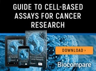 Guide to Cell-Based Assays for Cancer Research