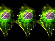 The Benefits of Imaging Flow Cytometry