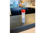 Fyn Antibody Works Well for Western Blot