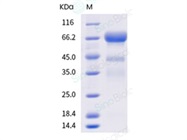 Host Cell Proteins: Byproducts from Biotherapeutics Production
