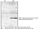 GSDMD Antibody Works Great