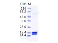 Human IL2 Protein (His Tag)
