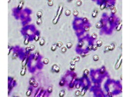Very Easy Differential Staining Kit
