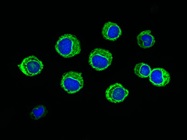 CRISPR-Engineered Immunotherapies Show Promise
