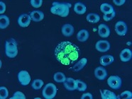 A Guide to Neutrophil Markers