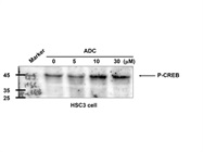 Great CERB (pser133) Antibody from GeneTex for Wb
