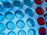 The Benefits of Digital PCR