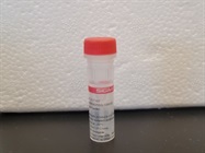 Anti-Paxillin Antibody for Western Blot