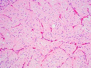 Review of Laser Microdissection Systems