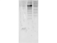 Anti-CPM Antibody Works Well
