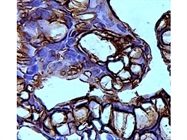 Reliable GFP Antibody for IHC-P