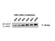 Dependable Phospho-SMAD3 Antibody for WB