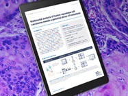 App Note: Multimodal Analysis of Human Squamous Cell Carcinoma Reveals a Potential Driver of Metastasis