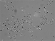 Greater Cell Culture Consistency with Digital Cell Imaging
