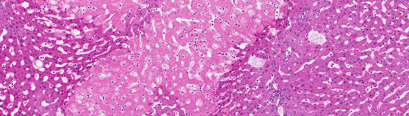  Predicting the Response to Checkpoint Inhibitors
