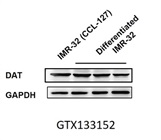 Excellent Antibody for Western Blot