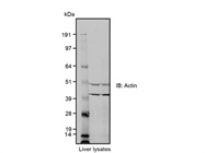 Ab8227 from Abcam Is Dependable