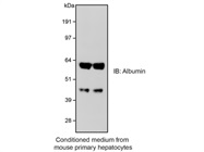 Albumin Antibody Gives Great Results