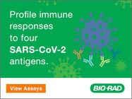 New: Easily monitor SARS-CoV-2 antibodies with multiplex immunoassays