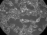 Enrichment/Depletion Strategies for Protein Analysis