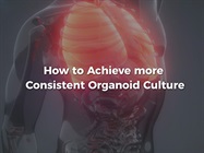 Watch Video: Corning Bench Tip - How to Achieve more Consistent Organoid Culture