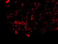 Good TNFR2 Antibody from Bioss