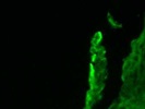 Excellent Cytokeratni 15 Antibody